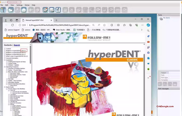 Hyperdent 10.0.2 