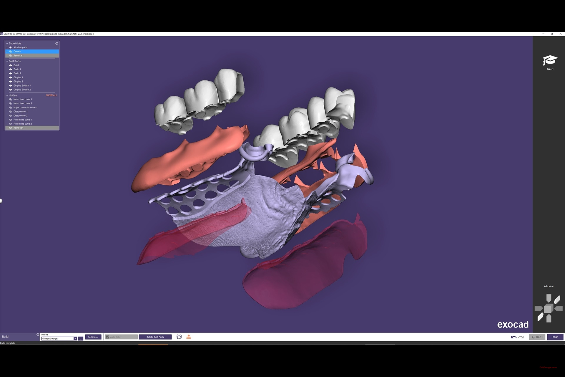 exocad partialcad 3.3 download